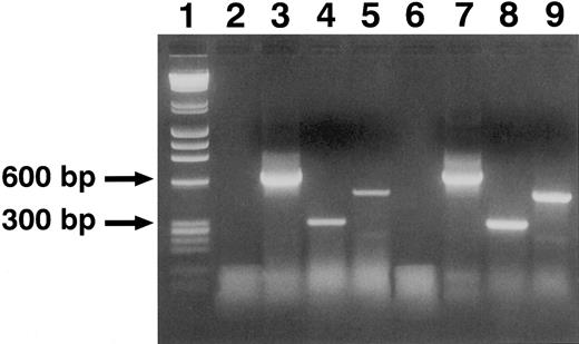 Fig. 2. RT-PCR analysis of expression of α chain of GM-CSFR in ECs (lanes 3 to 5) and U937 cell line (lanes 7 to 9). One microgram of total RNA was reverse-transcripted and amplified with GM-CSFRα1 –(lanes 4 and 8), GM-CSFRα2– (lanes 5 and 9), and β-actin– (lanes 3 and 7) specific oligonucleotides. Amplified products were run in an ethidium bromide-agarose gel and visualized by UV. In lane 1, molecular weight have been runned. Lanes 2 and 6 represent two control experiments performed with RT-PCR mixture without cell RNA. This experiment is representative of five performed with similar results.