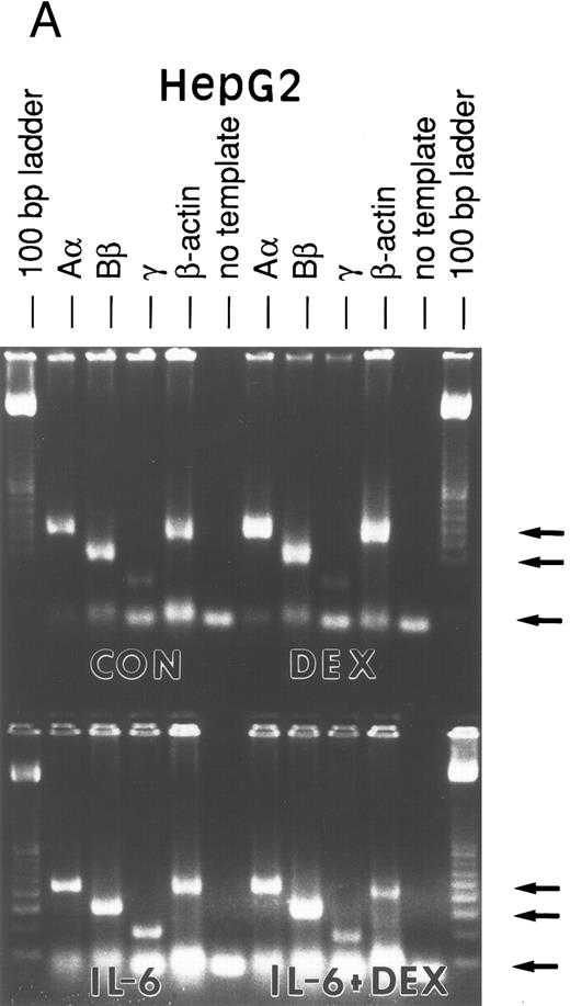 Fig. 2. RT-PCR amplification of FBG Aα, Bβ, and γ chain mRNAs. HepG2 cells (A) and A549 cells (B) were untreated (CON), or treated with DEX, IL-6, or DEX + IL-6. A control PCR reaction with no template was included. Total mRNA was amplified with FBG Aα, Bβ, and γ chain or β-actin primer pairs. The reaction products were resolved on 1.8% agarose gels in TAE buffer. The 100-, 300-, and 500-bp bands of the 100-bp ladder are denoted from top to bottom (arrows).