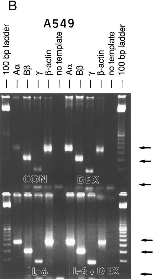 Fig. 2. RT-PCR amplification of FBG Aα, Bβ, and γ chain mRNAs. HepG2 cells (A) and A549 cells (B) were untreated (CON), or treated with DEX, IL-6, or DEX + IL-6. A control PCR reaction with no template was included. Total mRNA was amplified with FBG Aα, Bβ, and γ chain or β-actin primer pairs. The reaction products were resolved on 1.8% agarose gels in TAE buffer. The 100-, 300-, and 500-bp bands of the 100-bp ladder are denoted from top to bottom (arrows).
