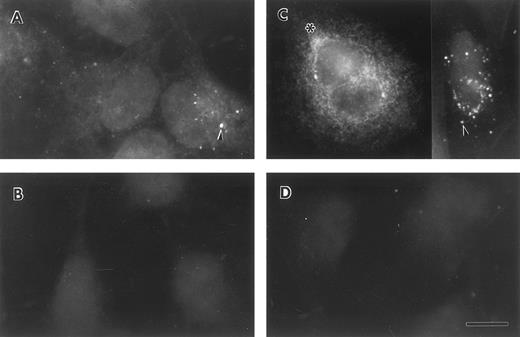 Fig. 4. Indirect immunofluorescent staining of control and DEX + IL-6 stimulated A549 cells. Untreated (A and B) and treated (C and D) lung epithelial cells were stained with purified anti-FBG IgG (A and C) or anti-FBG IgG pre-adsorbed with excess purified FBG (B and D). Asterisks denote positive staining in a spidery network pattern and arrowheads denote positive staining in discrete patches.43 The bar = 10 μm.