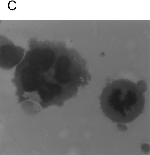 Fig. 1. Analysis of αIIbβ3 expression (A), DNA content (B), and morphology (C and D) of CD34+ cells, performed before or after 6 days of liquid culture with 100 ng/mL TPO. αIIbβ3 expression was examined with anti-CD41a MoAb directly conjugated to fluorescein and fluorescence was analyzed by FACScan. Negative controls are represented by cells treated with an isotype-matched irrelevant MoAb (anti-CD8) directly conjugated to fluorescein. The DNA content was examined by FACScan after PI staining. Cytospins were observed at light microscopy after May-Grünwald Giemsa staining (original magnification × 400). Flow cytometry results are expressed in arbitrary fluorescence units and represent means ± SD of four separate experiments.