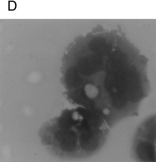 Fig. 1. Analysis of αIIbβ3 expression (A), DNA content (B), and morphology (C and D) of CD34+ cells, performed before or after 6 days of liquid culture with 100 ng/mL TPO. αIIbβ3 expression was examined with anti-CD41a MoAb directly conjugated to fluorescein and fluorescence was analyzed by FACScan. Negative controls are represented by cells treated with an isotype-matched irrelevant MoAb (anti-CD8) directly conjugated to fluorescein. The DNA content was examined by FACScan after PI staining. Cytospins were observed at light microscopy after May-Grünwald Giemsa staining (original magnification × 400). Flow cytometry results are expressed in arbitrary fluorescence units and represent means ± SD of four separate experiments.
