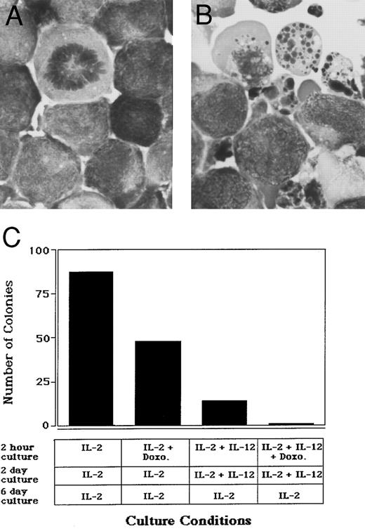 Fig. 7. Cytokine-induced apoptosis of a human LGL leukemia cell line. NK-92 cells were plated at a concentration of 5 × 105/mL in culture medium containing either (A) 15 ng/mL IL-2 alone or (B) IL-2 and 3 ng/mL IL-12 for 24 hours, after which cells underwent cytocentrifuge preparation and Wright-Giemsa staining. Original magnification × 330. (C) NK-92 cells were first cultured at a concentration of 1 × 105 cells/mL for 2 hours in medium containing: 15 ng/mL IL-2; IL-2 and 600 ng/mL doxorubicin; IL-2 and 3 ng/mL IL-12; IL-2, IL-12, and doxorubicin. Cells were next washed three times with RPMI 1640 and plated in a 96-well plate at 10 cells/well in the presence of IL-2 alone or IL-2 and IL-12, as indicated. After 2 days, each well was washed three times with RPMI 1640, and cultures were then continued in medium containing IL-2 for 6 more days. Wells were then visually scored for the presence of a viable colony. Similar results were obtained when IL-15 was substituted for IL-2 in these experiments (data not shown).