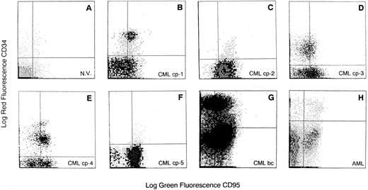 Fig. 1. Flow cytometric analysis of Fas-R expression on CD34+ cells derived from BM of CML patients. Total BM cells were stained with PE-conjugated CD34 and FITC-conjugated CD95 MoAb. Quadrants were set on the basis of cells treated with PE- and FITC-labeled isotypic controls. N.V., BM sample from a healthy volunteer; CML cp-1 to cp-5, BM samples from 5 patients with CML in chronic phase; CML bc, BM sample from a patient with CML in blastic crisis; AML, BM sample from a patient with acute myeloid leukemia. BM CD34+ cells were analyzed in the blast gate for CD95 expression.