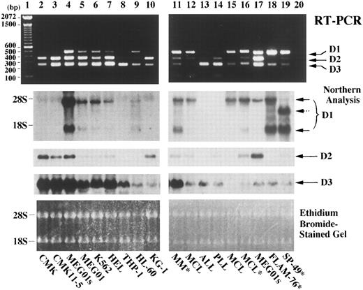 Fig. 4. Comparison between competitive RT-PCR and Northern analysis. RNAs extracted from the indicated cells on each lane were subjected to the competitive RT-PCR (upper part) and to Northern analysis (middle part). Cell lines are on lanes 2 through 10, 17, 18, and 19. Mononuclear cells from patients with multiple myeloma (MM),38 mantle cell lymphoma (MCL), B-cell acute lymphoblastic leukemia (ALL), or B-cell prolymphocytic leukemia (PLL) are on lanes 11 through 16. Mononuclear cells were obtained from bone marrow (lanes 11-13) or peripheral blood (lanes 14-16). Asterisks (*) denote that t(11; 14)(q13; q32) were documented. RNA extraction, the competitive RT-PCR, and Northern analysis were performed as described in Materials and Methods. Negative control of PCR product in the absence of any template is in lane 20. Arrows indicate PCR products corresponding to cyclins D1, D2, and D3 in the upper part, and cyclin D1, D2, and D3 transcript signals in the middle part. A dashed arrow indicates an aberrant cyclin D1 transcript observed in SP-49 cells.39 The sizes of 100-bp DNA ladders (lane 1) and ribosomal RNAs are shown on the left. RNA loading in each lane is shown in the photograph of the ethidium bromide-stained gel at the bottom.