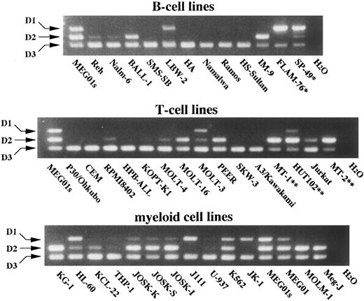 Fig. 5. Competitive RT-PCR analysis of hematopoietic cell lines for differential expression of D-type cyclins. The indicated B-cell lines (upper part), T-cell lines (middle part), and myeloid cell lines (lower part) at log phase were subjected to RNA extraction and competitive RT-PCR. PCR products were separated on an agarose gel containing ethidium bromide and photographed. Arrows indicate PCR products corresponding to cyclins D1, D2, and D3. MEG01s cells served as size markers. *t ( 11; 14 ) ( q13; q32 ) - bearing cell lines; **HTLV-1–infected cell lines.