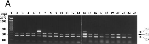 Fig. 6. Cyclin D1 expression in peripheral blood, bone marrow, and lymph nodes. (A) Peripheral blood (100 μL each, lanes 2-22) of patients in the hematology outpatient clinic were subjected to RNA extraction and the competitive RT-PCR as described in Materials and Methods. (B) Lymph node cells of a patient with necrotizing lymphadenitis (lane 25) and of lymphoma patients (lanes 26-31) and bone marrow aspirates (50 μL each, lanes 32-35) of lymphoma patients without bone marrow involvement were also subjected to RNA extraction and the competitive RT-PCR. Diseases affecting these patients were as follows: lanes 2, 11, and 22, pernicious anemia; lanes 3 and 5, collagen disease; lane 4, idiopathic thrombocytopenic purpura; lane 6, lymphoplasmacytic lymphoma with bcl-1 rearrangement and cyclin D1 overexpression; lane 7, acute myeloid leukemia in complete remission; lanes 8 and 26-28, follicular lymphoma; lane 9, pulmonary infiltrate with eosinophilia; lanes 10 and 29-31, diffuse lymphoma; lanes 12, 13, 18, and 19, non-Hodgkin's lymphoma in complete remission; lanes 14 and 20, chronic myeloid leukemia in the accelerated phase; lane 15, aplastic anemia; lane 16, myelodysplastic syndrome; lane 17, autoimmune hemolytic anemia; lane 21, iron-deficiency anemia. Negative controls of PCR without added template are in lanes 23 and 36. The sizes (bp) of 100 bp DNA ladders (lanes 1 and 24) are shown on the left.