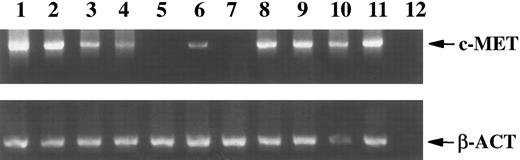 Fig. 1. Expression (RT-PCR) of c-MET and β-actin (β-act; used as a positive control) mRNA in 104 BM cells (lane 1), 106 PBMC (lane 2), and in 104 FACS STAR sorted CD34+ cells from BM (lane 3), immature B cells isolated from BM (CD19+CD20−, lane 4), mature B cells from BM (CD19+CD20+, lane 5), and B cells isolated from umbilical cord (CD19+, lane 6), PB B lymphocytes, either unstimulated (lane 7), stimulated with PMA (lane 8), ConA (lane 9), HGF/SF (lane 10), or infected with EBV (lane 11). Lane 12 is the water control for the PCR.