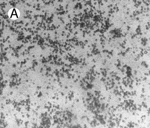 Fig. 5. Adhesion of BJAB cells to Matrigel coated on membranes of Boyden chambers in the presence (A) or absence (B) of HGF/SF (15 ng/mL) for 16 hours.