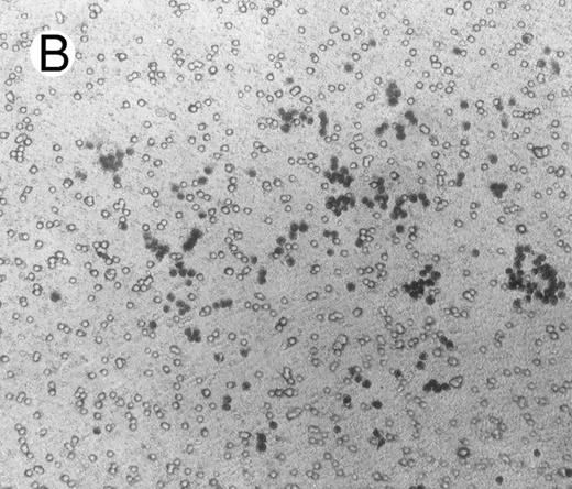 Fig. 5. Adhesion of BJAB cells to Matrigel coated on membranes of Boyden chambers in the presence (A) or absence (B) of HGF/SF (15 ng/mL) for 16 hours.