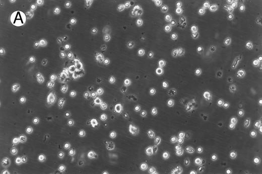 Fig. 1. Morphology of freshly isolated and cultured CML cells. PBMNCs from chronic-phase CML patients were isolated and cultured as described in the Materials and Methods. The results depicted are phase-contrast micrographs of freshly isolated cells (A) and after 10 days of culture in the presence of GM-CSF, IL-4, and TNF-α (B).