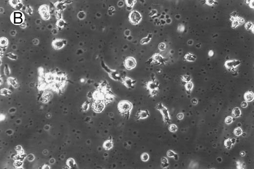 Fig. 1. Morphology of freshly isolated and cultured CML cells. PBMNCs from chronic-phase CML patients were isolated and cultured as described in the Materials and Methods. The results depicted are phase-contrast micrographs of freshly isolated cells (A) and after 10 days of culture in the presence of GM-CSF, IL-4, and TNF-α (B).