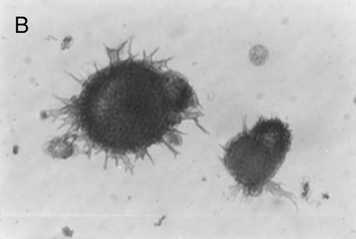 Fig. 2. Immunoperoxidase staining of of freshly isolated and cultured CML cells with anti-CD1a antibody. Freshly isolated (A) or 10-day cultured, nonadherent CML cells (B) were adhered to poly-l-lysine–coated coverslips and stained with anti-CD1a and peroxidase-conjugated antimouse IgG. Cells stained with isotype control antibody and peroxidase conjugate were similar to those depicted in (A) (data not shown).