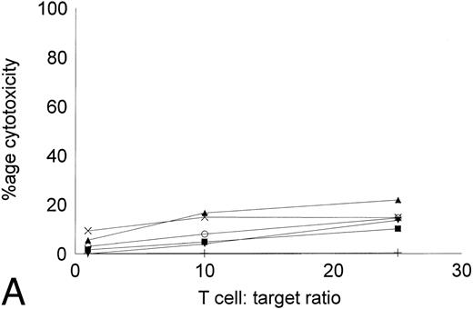 Fig. 5. Cytotoxicity of IL-2–expanded or DC-stimulated T cells against autologous CML targets. Autologous CML BMMNCs were incubated with various ratios of T cells stimulated with IL-2 alone (A) or IL-2 and DCs (B) for 6 hours, and the cell-free supernatants were assayed for LDH enzyme released. Maximum release was determined by lysing an equal number of target cells with 0.5% Triton X-100. Values were normalized for spontaneous release of enzyme by target and effector cells cultured alone. The symbols represent the results with individual patients. The data points shown were calculated using the mean value of triplicate cultures.