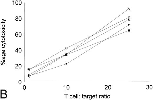 Fig. 5. Cytotoxicity of IL-2–expanded or DC-stimulated T cells against autologous CML targets. Autologous CML BMMNCs were incubated with various ratios of T cells stimulated with IL-2 alone (A) or IL-2 and DCs (B) for 6 hours, and the cell-free supernatants were assayed for LDH enzyme released. Maximum release was determined by lysing an equal number of target cells with 0.5% Triton X-100. Values were normalized for spontaneous release of enzyme by target and effector cells cultured alone. The symbols represent the results with individual patients. The data points shown were calculated using the mean value of triplicate cultures.