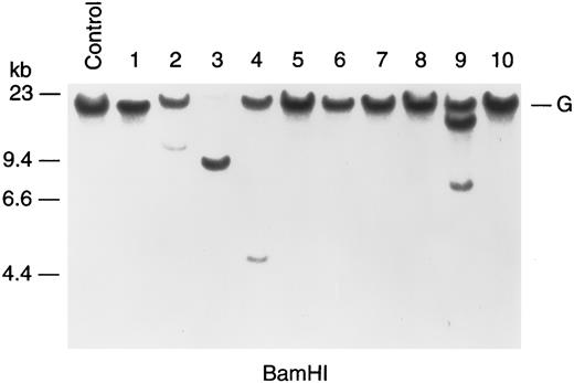 Fig. 2. Southern blot of genomic DNA. DNA was digested with BamHI and the blot was hybridized with pSB. Control lane contains nonleukemic DNA. Lanes 1 through 10 contain DNA from 10 ALL cases. Molecular weight markers are shown on the left and germline TEL (G) is indicated. In this example, cases no. 2, 3, 4, and 9 show rearrangements of TEL.
