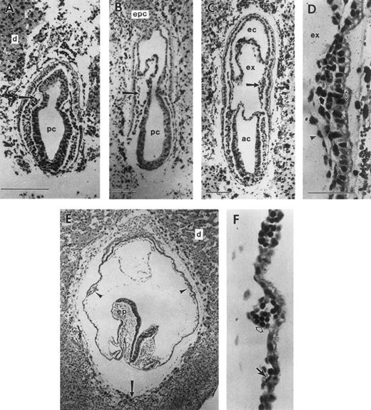 Fig. 1. Development of the mouse conceptus from the mid-primitive streak to early somite stages. All sections are longitudinal with the exception of (E) and (F ), which are frontal. (A) Mid-primitive streak stage conceptus (E7.25) with the proamniotic cavity (pc) lined by ectoderm cells. Mesoderm cells are beginning to form a cavity (arrow) that will expand to form the exocoelom (ex). (B) Late-primitive streak stage conceptus with an expanded exocoelomic cavity (arrow) in extraembryonic mesoderm. (C) Neural plate stage conceptus (E7.5). Extraembryonic mesoderm cells forming the lateral wall of the exocoelom are proliferating to form a mesodermal cell mass (arrow). (D) Higher magnification of a mesodermal cell mass, consisting of flattened mesothelial cells (arrowhead) lining the exocoelom and proliferating undifferentiated mesoderm cells (closed arrow). The mesodermal cell mass is apposed to the single cell layer of visceral endoderm (open arrow) with its brush border facing the yolk sac cavity. (E) Early somite stage conceptus with multiple yolk sac blood islands (2 blood islands are indicated with arrowheads). Trophoblast giant cells (arrow) are in contact with the maternal decidual tissue (d). (F ) Blood islands at the early somite stage consisting of differentiating erythroid cells (open arrow) and endothelial cells (closed arrow). ac, amniotic cavity; d, deciduum; ec, ectoplacental cavity; epc, ectoplacental cone; ex, exocoelomic cavity; pc, proamniotic cavity; ep, embryo proper. Each scale bar represents 100 μm and the magnification of (F ) is the same as (D).