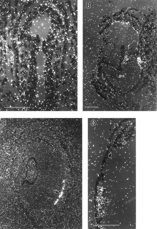 Fig. 3. In situ hybridization with a GATA-1 antisense probe. (A) Mid-primitive streak stage conceptus with no localized signal above background. (B) Late-primitive streak stage conceptus with GATA-1 mRNA expression present in the mesoderm cell mass (closed arrow). There is expression evident in extraembryonic ectoderm cells of the chorion (open arrow). (C) Early somite stage conceptus with localized signal in yolk sac blood islands (arrow). (D) Higher magnification of an early somite stage conceptus, with GATA-1 mRNA present in yolk sac blood islands (arrow). Low levels of GATA-1 transcripts are also evident in extraembryonic ectoderm cells of the chorion (open arrow) compared to yolk sac endoderm (closed arrow). GATA-1 sense probes gave similar high generalized background with no localized signal (data not shown). ep, embryo proper; m, mesoderm; pc, proamniotic cavity. Each scale bar represents 100 μm.