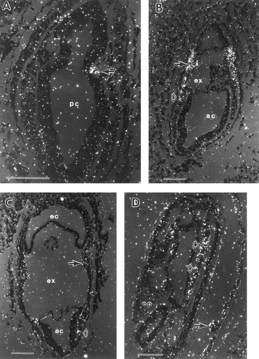 Fig. 6. In situ hybridization with a tal-1 antisense probe. (A) Mid-primitive streak stage conceptus with tal-1 mRNA expression localized to 2 extraembryonic mesoderm cells. Serial sections probed with antisense tal-1 gave similar results. (B) Late-primitive streak stage conceptus with tal-1 signal restricted to VYS mesoderm (closed arrow) and posterior embryonic mesoderm (open arrow). (C) Neural plate stage conceptus with tal-1 mRNA present in both VYS mesoderm (closed arrow) and posterior embryonic mesoderm (open arrow). (D) Early somite stage conceptus with low levels of tal-1 mRNA expression in yolk sac blood islands (closed arrow) and in regions of embryonic mesenchyme (open arrows). ac, amniotic cavity; ex, exocoelomic cavity; pc, proamniotic cavity; ep, embryo proper. Each scale bar represents 100 μm.
