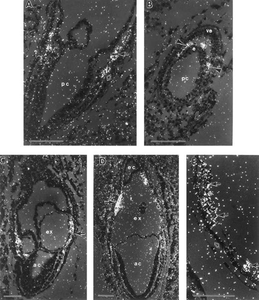 Fig. 7. In situ hybridization with an rbtn2 antisense probe. (A) Mid-late primitive streak stage conceptus with rbtn2 mRNA expression in both extraembryonic mesoderm (closed arrow) and posterior embryonic mesoderm (open arrow). (B) Transverse oblique section of a mid-primitive streak stage conceptus with rbtn2 mRNA confined to mesoderm cells located between the inner epiblast cells (e) and the outer visceral endoderm cells (ve). rbtn2 transcripts are present both in the axial mesoderm and in the mesodermal wings (arrowheads). (C) Late-primitive streak stage conceptus with rbtn2-positive extraembryonic mesoderm cells (arrow). (D) Neural plate stage conceptus with rbtn2 transcripts present in both mesodermal cell masses (closed arrow) and posterior embryonic mesoderm (open arrow). (E) Early somite stage yolk sac with rbtn2 mRNA accumulation in cells within blood islands (closed arrows), but not in the yolk sac endoderm (open arrow). There was no signal above background in the sense controls. ac, amniotic cavity; e, epiblast; ec, ectoplacental cavity; ex, exocoelomic cavity; pc, proamniotic cavity; ve, visceral endoderm. Each scale bar represents 100 μm.