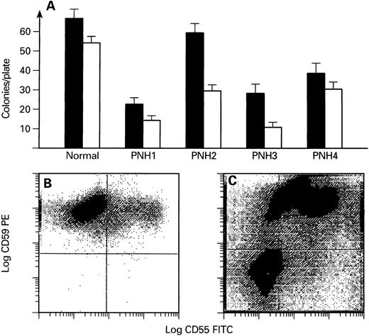 Fig. 4. Colony formation by BM CD34+ cells derived from patients with PNH. (A) Bars represent erythroid (▪) and myeloid (□) colony formation by normal volunteers (n = 10) and 4 patients with PNH. (B and C) Flow cytometric analysis of progeny derived from cultures of CD34+ cells of a normal volunteer (B) and a patient with PNH (PNH-1; C). Cells were separated from methylcellulose, washed, and stained with MoAbs directed against CD55 and CD59. Log PE fluorescence intensity versus log FITC fluorescence intensity is plotted. Gates were set based on the isotypic controls.