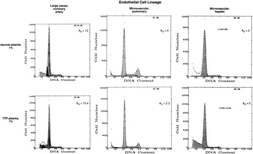Fig. 2. Effect of TTP plasma on coronary artery EC and MVEC of pulmonary and hepatic origin. Primary human EC were cultured and evaluated as described in the legend to Fig 1.