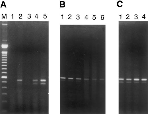 Fig. 5. RT-PCR for Fas (CD95) expression in EC. PCR analysis of cDNA reverse transcribed from RNAs obtained from microvascular EC of various tissues and from large vessel umbilical vein and coronary artery EC cultured for 18 hours in the presence of various plasmas (1:100 dilutions) was performed. Simultaneous RT-PCR for β-actin, using aliquots from these same samples, served as a control for integrity of the starting materials and gave equivalent signals for all samples (data not shown). The two bands for Fas recognized in some lanes represent the membrane-bound and secreted forms of this molecule.17 (A) Lane 1, dermal MVEC-2 + normal plasma; lane 2, dermal MVEC-2 + TTP-1; lane 3, renal HMVEC-G + normal plasma; lane 4, renal HMVEC-G + TTP-1; lane 5, renal HMVEC-G + TTP-2. (B) Lane 1, pulmonary HMVEC-LU + normal plasma; lane 2, pulmonary HMVEC-LU + TTP-1; lane 3, pulmonary HMVEC-LU + TTP-2; lane 4, hepatic HMVEC-H + normal plasma; lane 5, hepatic HMVEC-H + TTP-1; lane 6, hepatic HMVEC-H + TTP-3. (C) Lane 1, UVEC + normal plasma; lane 2, UVEC + TTP-1; lane 3, coronary HCAEC + normal plasma; lane 4, coronary HCAEC + TTP-1.
