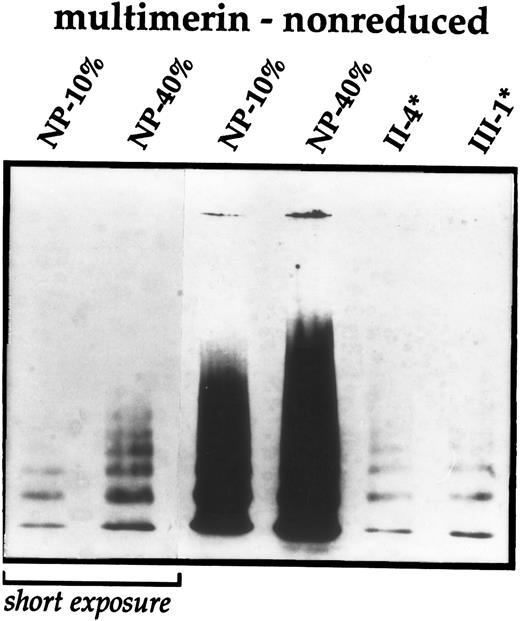 Fig. 3. Immunoblot analyses of platelet multimerin. Washed platelet lysates from several affected family members (*) were compared with dilutions of normal pooled platelet lysate (NP) and analyzed using nonreduced multimer gels and immunoblotting with monoclonal antimultimerin (JS-1). A short exposure of the multimers in the normal pooled lysate is shown for comparison. Similar multimerin abnormalities were found in patient II-13.