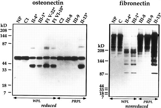 Fig. 4. Immunoblot analyses of platelet osteonectin and fibronectin. Samples of WPL or PRPL from patients (*), unaffected family members, healthy controls (C), the normal pool (NP), and individuals from the first family (F1) were analyzed using SDS-PAGE and monoclonal (osteonectin) or polyclonal (fibronectin) antibodies.