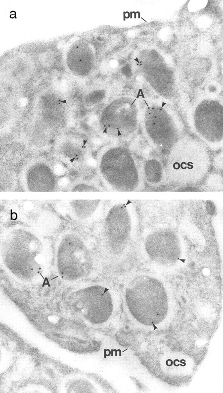 Fig. 7. Immunogold localization of multimerin in patient (III-1) and control platelets. (a) The characteristic, eccentric labeling of α-granular (A) multimerin17 (arrowheads) is seen in the control platelets. The plasma membrane (pm) and open cannalicular system (ocs) are not labeled. (b) The patient's platelets contain fewer immunogold particles per α-granule (A). However, the eccentric multimerin labeling pattern is preserved and no gold particles are found in structures other than α-granules. (Original magnification × 65,000 for both panels.)