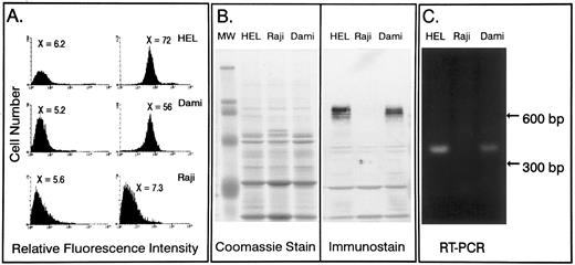 Fig. 1. Characterization of PECAM-1 expression on leukocyte tumor cell lines. The human leukocyte cell lines HEL, Dami, and Raji were examined for PECAM-1 expression. (A) Flow cytometric analysis of PECAM-1 expression. Cells were stained with either normal rabbit IgG or the human PECAM-1–specific polyclonal rabbit IgG, SEW16. Detection was accomplished by staining with a dichlorotriazinyl amino fluorescein-conjugated goat antirabbit IgG. As shown, HEL and Dami cells, express PECAM-1 on their surface, whereas Raji cells are negative. (B) Western blot analysis of PECAM-1 expression in HEL, Dami, and Raji cells was performed using SEW16. Detection was accomplished using alkaline phosphatase-conjugated goat antirabbit secondary antibody. Note that Raji cells do not contain even an intracellular pool of detectable PECAM-1. (C) RT-PCR analysis of PECAM-1 mRNA levels. mRNA was isolated from HEL, Dami, and Raji cells and subjected to RT-PCR using primers spanning a 400-bp region of PECAM-1 that include exons 2 and 3. These primers would yield a PCR product of greater than 12-kb product if amplification were to occur from genomic DNA. As shown, both HEL and Dami cells express PECAM-1 mRNA, whereas Raji cells are negative.