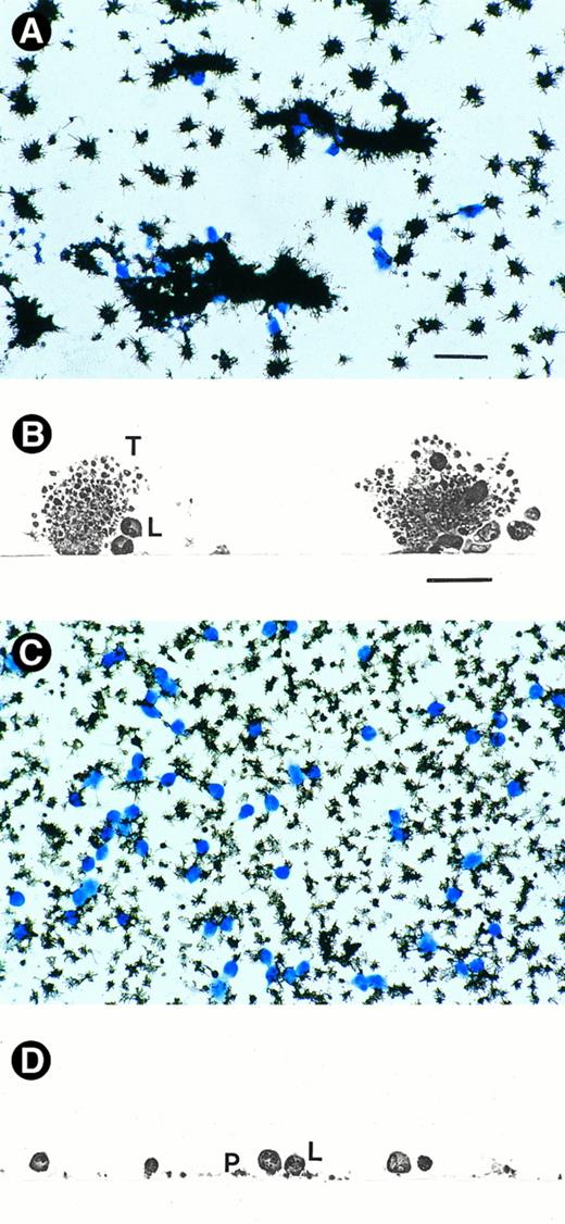 Fig. 1. Leukocyte adhesion to platelet thrombi and platelet monolayers. Collagen-coated surfaces were exposed for 5.5 minutes to flowing human blood (shear rate, 65/s) that was anticoagulated by infusion of thrombin inhibitor. To obtain collagen-adherent platelet monolayers, platelet aggregation on top of the adherent platelets was prevented by additional infusion of the GPIIb-IIIa antagonist. (A and C) “En face” view of coverslips with platelet thrombi (A) and platelet monolayers (C). P-selectin–expressing platelets (black) were visualized by an immunogold-silver staining using a monoclonal anti–P-selectin antibody, and the adherent leukocytes (blue) were stained with Diff-Quick solution. (B and D) Cross sections of coverslips with platelet thrombi (B) and platelet monolayers (D). Leukocytes can be seen to adhere to the deposited platelet thrombi (in B) and to single collagen-adherent platelets (in D). L, leukocytes; P, single adherent platelet; T, platelet thrombus.