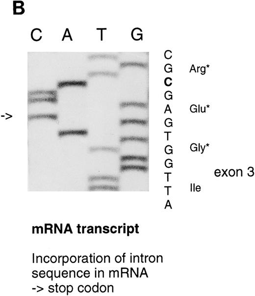 Fig. 3. Sequencing gels demonstrating the patients' DNA-mutation and the variant mRNA transcripts. (A) Sequencing of the patients' DNA shows a novel mutation, a heterozygous T → C transition at position +6 of intron C. (B) Sequencing of the RT-PCR product through exon 3/intron C boundary shows the incorporation of intronic sequence into the patients' mRNA and the T → C transition at position +6. * indicates altered amino acid sequence. (C) Sequencing of a truncated RT-PCR product in the antisense direction shows skipping of exon 3 (correct sequence in the boundary exons 2 and 3 is CAAG/AGTTT and exons 3 and 4 is ATTG/GTCGT.20 (D) Sequencing of a truncated RT-PCR-product shows skipping of exons 3 and 4 (correct sequence in the boundary of exons 4 and 5 is GAAG/ATGAG.20