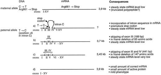 Fig. 4. Schematic presentation of the different mRNA transcript species in patients II-1 and II-3. Maternal allele produces reduced amount of a 3.9-kb mRNA that contains the Arg661 → Stop mutation in exon XIV. The paternal allele produces several mRNA variants. One of the transcripts contains sequence from intron C, which creates a premature stop codon in the mRNA. Two of the transcripts show exon skipping. In a more abundant transcript, exon 3 has been skipped and in a more rare transcript, both exons 3 and 4 have been skipped. Most importantly, the paternal allele also produces a minute amount of correctly spliced mRNA, thus facilitating the production of some active enzyme and resulting in a mild disease phenotype.