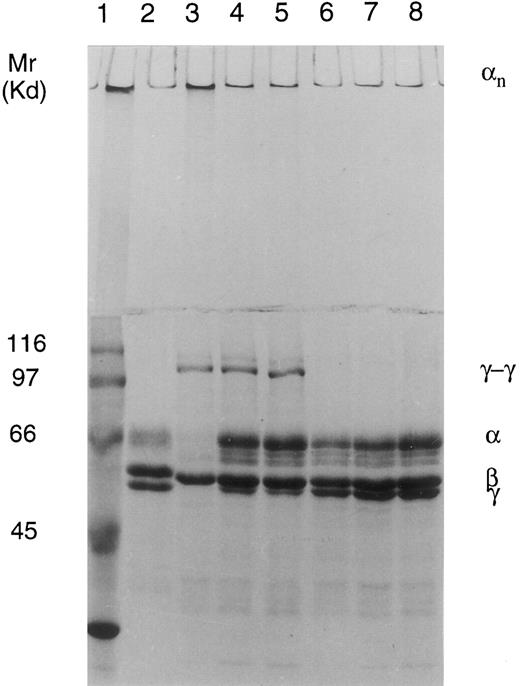 Fig. 5. Cross-linking of fibrin in normal and FXIII-deficient plasma clotted by thrombin and CaCl2 shown on 7.5% SDS-PAGE. Lane 1, Mr marker proteins; lane 2, fibrinogen standard; lane 3, control plasma; lane 4, patient II-3; lane 5, patient II-1; lane 6, control plasma + iodoacetamide acid (IAA); lane 7, patient II-3 + IAA; and lane 8, patient II-1 + IAA. Cross-linking pattern in the control plasma shows disappearance of γ- and α-chains and formation of γ-γ dimers and α polymers. Cross-linking pattern in the patients; plasma shows diminution of the γ-chains and formation of γ-γ dimers and possibly even some α polymers at the top of the stacking gel, indicating the presence of true FXIII activity. The process is inhibited by treatment with transglutaminase inhibitor iodoacetamide acid.