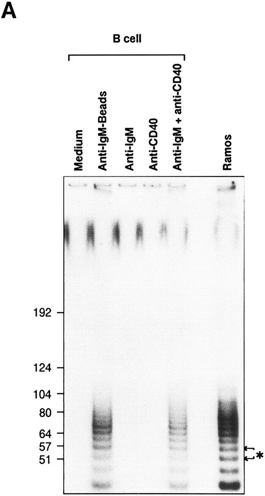 Fig. 1. Induction of telomerase activity in normal B cells. Intrinsic telomerase activity was measured by TRAP assay as described in Materials and Methods. (A) Purified B cells from tonsils were stimulated in vitro with soluble goat antihuman IgM Ab (10 μg/mL), goat antihuman IgM Ab bound to beads (10 μg/mL), anti-CD40 MoAb (10 μg/mL) or soluble anti-IgM Ab plus anti-CD40 MoAb for 2 days. (B) Tonsillar B cells were stimulated with various kinds of cytokines in the presence or absence of soluble anti-IgM Ab (10 μg/mL) for 2 days. TRAP assay was performed using the lysate from cells that showed equivalent proliferation. (C) Telomerase activity was measured at the points of 12, 24, 48, 72, 96, 120, 144, and 168 hours after the stimulation with soluble anti-IgM Ab plus anti-CD40 MoAb.