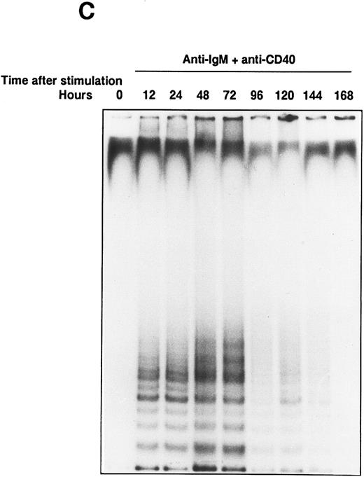 Fig. 1. Induction of telomerase activity in normal B cells. Intrinsic telomerase activity was measured by TRAP assay as described in Materials and Methods. (A) Purified B cells from tonsils were stimulated in vitro with soluble goat antihuman IgM Ab (10 μg/mL), goat antihuman IgM Ab bound to beads (10 μg/mL), anti-CD40 MoAb (10 μg/mL) or soluble anti-IgM Ab plus anti-CD40 MoAb for 2 days. (B) Tonsillar B cells were stimulated with various kinds of cytokines in the presence or absence of soluble anti-IgM Ab (10 μg/mL) for 2 days. TRAP assay was performed using the lysate from cells that showed equivalent proliferation. (C) Telomerase activity was measured at the points of 12, 24, 48, 72, 96, 120, 144, and 168 hours after the stimulation with soluble anti-IgM Ab plus anti-CD40 MoAb.