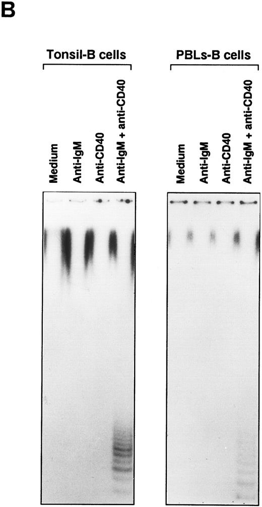 Fig. 2. Induction of telomerase activity in B cells of tonsils and PBLs. (A) Tonsillar B cells were stimulated with either biotin-labeled mouse antihuman IgM MoAb (10 μg/mL) or biotin-labeled mouse antihuman IgD MoAb (10 μg/mL) in combination with anti-CD40 MoAb (10 μg/mL). Streptavidin (20 μg/mL) was used for the hypercross-linkage of BCR. (B) B cells of tonsils and PBLs from the same donor were stimulated for 2 days with the various stimulatory reagents indicated. After stimulation, TRAP assay was conducted.