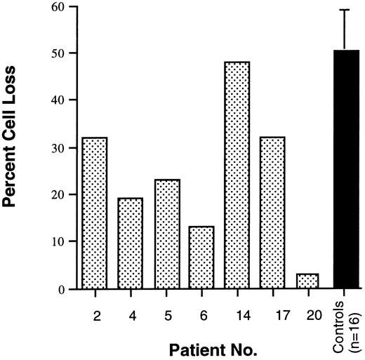 Fig. 3. Fas-mediated killing of EBV-transformed B-cell lines derived from 7 ALPS patients and 16 normal controls. The percentage of cell loss was calculated from cultures of EBV-transformed B-cell lines exposed to the anti-Fas MoAb CH11. Patient no. 14 lacked a Fas mutation. Mean and standard deviation are shown for controls.