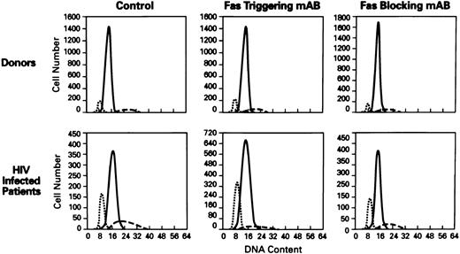 Fig. 2. Cell-cycle analysis of lymphocytes treated with anti-Fas MoAb (CH11). Flow cytometric analysis of nuclei of lymphocytes stained with propidium iodide (N = 60). Hypoploid peak reflects the percentages of apoptotic cells. X axis, DNA content; Y axis, cell number. The histograms of PBMCs from normal donor (top) and HIV+ patient (bottom) showed the following: control (untreated lymphocytes), treated with Fas triggering antibody (CH11), treated with Fas blocking MoAb (ZB4). (⋅⋅⋅) The apoptotic peak; ( — ) the G1 phase; (- - -) the G2 phase of cell cycle.