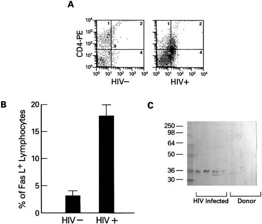 Fig. 5. Expression of cell-free soluble and membrane-associated Fas-L by lymphocytes from HIV-1–infected persons. (A and B) Expression of Fas-L on normal (HIV−) and HIV-1–infected lymphocytes. Lymphocytes from HIV-1–infected patients (N = 10) and normal controls (N = 10) were dually stained with PE-conjugated CD4 or CD8 MoAb and FITC-conjugated anti–Fas-L. Columns at the left represent the numbers of CD4 or CD8 cells that reacted with Fas-L (B). An example scattergram (A) showing binding of CD4 PE on the Y axis and anti–Fas-L (FITC) on the X axis for both an HIV-1–infected patient and a normal control are represented. (C) Western blot of cell-free suspension from cultures from normal donors and lymphocytes from HIV-1–infected patients. PBMCs from normal controls (N = 20) and HIV-1–infected patients (N = 20) were cultured as previously described for 72 hours. Cell-free supernatants were prepared as described in Materials and Methods, and samples were analyzed by Western blotting using MoAb to Fas-L.