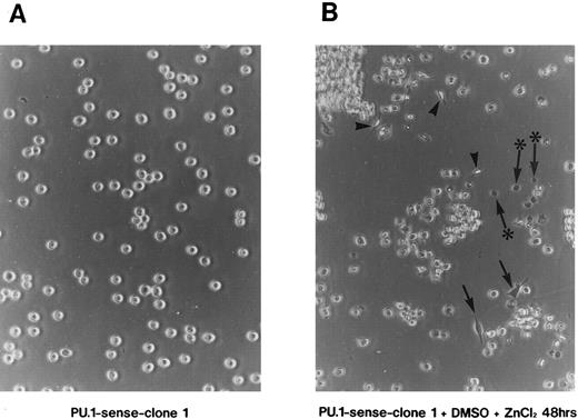 Fig. 4. Induction of apoptosis in PU.1-overexpressing cells. (A) Morphology of PU.1-sense clone 1 cells cultured in the ordinary medium. (B) Morphology of the same cells cultured with 1.5% DMSO and 100 μmol/L ZnCl2 for 48 hours. Arrows point to the flat cells attaching to the bottom of culture dishes, arrowheads to the spindle-like cells, and arrows with an asterisk to the dead cells. (C) DNA fragmentation analysis of the parental MEL-B8/3 cells and transfectants cultured under various conditions. DNA was extracted from the cells cultured for 48 hours in the ordinary medium or in the medium containing 1.5% DMSO and/or 100 μmol/L ZnCl2 and was electrophoresed in a 1.5% agarose gel. (D) The ultrastructural appearance of a PU.1-sense clone 1 cell showing characteristic features of apoptosis after 48 hours of culture with 1.5% DMSO and 100 μmol/L ZnCl2 . Note the dense chromatin aggregation under the nuclear membrane and no remarkable changes of the mitochondria and other organelles. Scale bar, 1 μm.