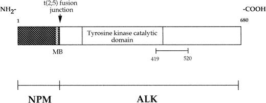 Fig. 1. Schematic diagram of the NPM-ALK fusion protein. As a result of the 2; 5 translocation, the amino-terminal portion of NPM is fused to the intracellular region (including the tyrosine kinase domain) of ALK. The recombinant protein used to raise the MoAb ALK1 consists of the portion of ALK between amino acids 419 and 520, inclusive. MB indicates putative metal binding site.