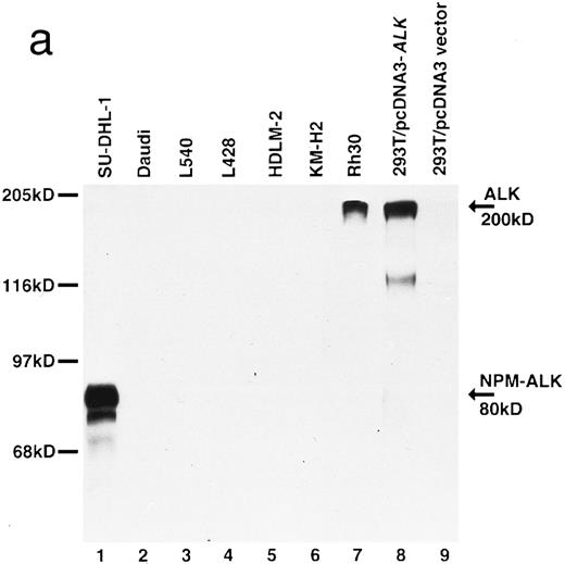 Fig. 2. Biochemical characterization of antibody ALK1. (a) Cell lysates were separated by SDS-PAGE and then subjected to Western blotting. Antibody ALK1 recognizes a protein of 80 kD in the t(2; 5)+ SU-DHL-1 cell line (lane 1). No protein bands are detected in the Daudi B-cell line or the Hodgkin's-derived cell lines L540, L428, HDLM-2, and KM-H2 (lanes 2 through 6). However, antibody ALK1 did detect a band of 200 kD in lysates of the human rhabdomyosarcoma Rh30 cell line (lane 7) that expresses the full-length ALK receptor protein19 and in 293T (human embryonic kidney epithelial) cells that had been transfected with a cDNA encoding the full-length ALK protein (lane 8). No bands were seen in 293T cells that had been tranfected with pcDNA3 vector only (lane 9). The smaller bands seen in the lysates from the SU-DHL-1 and 293T cells transfected with pcDNA3-ALK have been observed using polyclonal anti-ALK sera ( S.W. Morris, personal communication, March 1996) and probably represent proteolytic breakdown products of the NPM-ALK and ALK proteins, respectively. (b) Immunoprecipitates prepared from SU-DHL-1 and Daudi cell lysates using the antiphosphotyrosine antibody 4G10 were subjected to SDS-PAGE and then electroblotted. The blots were then stained with either the antiphosphotyrosine antibody 4G10 (lanes 1 and 2) or with antibody ALK1 (lanes 3 and 4). The t(2; 5)+ SU-DHL-1 cell line contained many phosphorylated proteins (lane 1) in contrast to only two found in the Daudi cell line (lane 2). Antibody ALK1 labeled only the prominent 80-kD phosphorylated NPM-ALK protein present in the SU-DHL-1 cells (lane 3). No bands were detected by antibody ALK1 in the Daudi cell immunoprecipitate (lane 4). The position of molecular weight standards (myosin, 205 kD; galactosidase, 116 kD; phosphorylase, 97 kD; bovine serum albumin, 68 kD; and ovalbumin, 45 kD) are indicated.