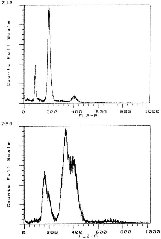 Fig. 4. DNA flow cytometry of a tetraploid tumor with a small octoploid peak (no. 712). DNA flow cytogram with a double G0/G1 and G2/M peak, indicating the presence of two tetraploid stem lines with a DNA index of 1.25 (no. 258).