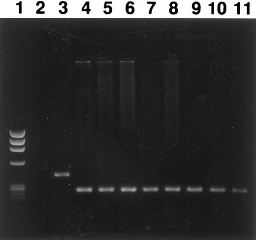 Fig. 7. Engraftment of donor bone marrow in the B10.D2 → BALB/c transplant documented by PCR amplification of a polymorphic microsatallite region within the IL-1β gene. Long-term engraftment of allogeneic bone marrow was found in all transplanted mice. This figure demonstrates one representative analysis on an ethidium bromide–stained 1.5% agarose gel. Lane 1, DNA marker φx174 digested with HaeIII (marker sizes: 1,353, 1,078, 872, 603, 310, 281, 271, 243, and 194 bp; GIBCO BRL, Gaithersburg, MD); lane 2, negative control (PCR without DNA); lane 3, recipient (BALB/c) standard; lane 4, donor (B10.D2) standard; lanes 5, 6, 7, and 8, recipients given CD31 peptide (ID no. 669, 670, 672, and 674); lane 9, recipient given control peptide (ID no. 691); lanes 10 and 11, recipients given PBS (ID no. 773 and 774).