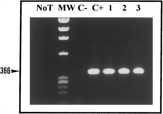 Fig. 4. RT-PCR with primers detecting ALK mRNA corresponding to the tyrosine kinase domain of the ALK receptor. Total RNAs extracted from the t(2; 5)-bearing SU-DHL1 cell line (lane C+) and a t(2; 5)-positive case of ALCL (lane 1) show the expected band of 366 bp. Note that the two cases (cases 1 and 6) under study (lanes 2 and 3), which are negative for NPM-ALK transcripts, also show a band of 366 bp. RNA from the CEM T-cell line yielded no product (C−). NoT, no template cDNA, MW, molecular-weight markers.
