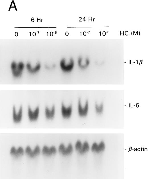 Fig. 3. GCs downregulate (A) IL-1 and IL-6, (B) IL-6 protein, (C) bFGF, and (D) VEGF. For mRNA studies, KS cells were seeded in 75-cm2 flasks and treated with hydrocortisone (10−6 and 10−7 mol/L). The cells were obtained at 6 or 24 hours. Total RNA was extracted and assayed by the Northern method. The membranes were also probed for β-actin to normalize for the quantity of RNA. For IL-6 protein assays, equal numbers of cells were seeded in triplicate wells and treated with hydrocortisone (10−6 mol/L). Supernatants were collected at various time points, cleared of cell debris by centrifugation, and assayed by ELISA for IL-6. The results represent mean ± SE.