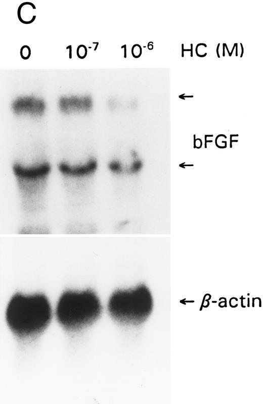 Fig. 3. GCs downregulate (A) IL-1 and IL-6, (B) IL-6 protein, (C) bFGF, and (D) VEGF. For mRNA studies, KS cells were seeded in 75-cm2 flasks and treated with hydrocortisone (10−6 and 10−7 mol/L). The cells were obtained at 6 or 24 hours. Total RNA was extracted and assayed by the Northern method. The membranes were also probed for β-actin to normalize for the quantity of RNA. For IL-6 protein assays, equal numbers of cells were seeded in triplicate wells and treated with hydrocortisone (10−6 mol/L). Supernatants were collected at various time points, cleared of cell debris by centrifugation, and assayed by ELISA for IL-6. The results represent mean ± SE.