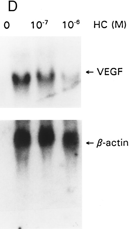 Fig. 3. GCs downregulate (A) IL-1 and IL-6, (B) IL-6 protein, (C) bFGF, and (D) VEGF. For mRNA studies, KS cells were seeded in 75-cm2 flasks and treated with hydrocortisone (10−6 and 10−7 mol/L). The cells were obtained at 6 or 24 hours. Total RNA was extracted and assayed by the Northern method. The membranes were also probed for β-actin to normalize for the quantity of RNA. For IL-6 protein assays, equal numbers of cells were seeded in triplicate wells and treated with hydrocortisone (10−6 mol/L). Supernatants were collected at various time points, cleared of cell debris by centrifugation, and assayed by ELISA for IL-6. The results represent mean ± SE.
